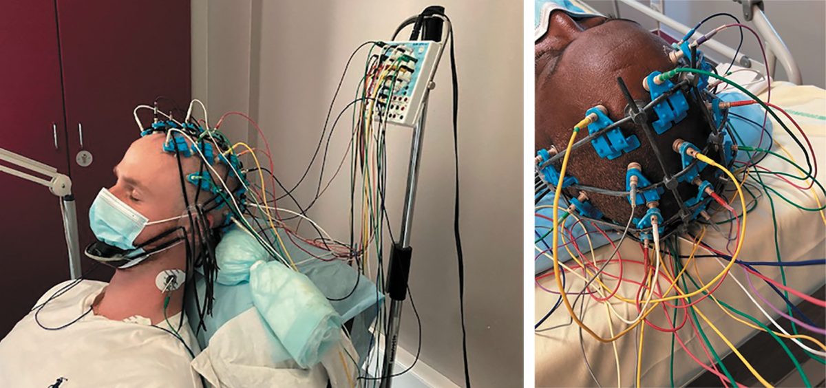 Fiche technique sur l’EEG Neurologies