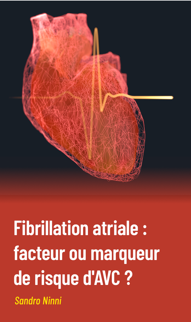 Fibrillation atriale : facteur ou marqueur de risque d’AVC ?