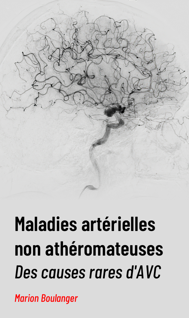 Maladies artérielles non athéromateuses