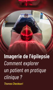 imagerie épilepsie