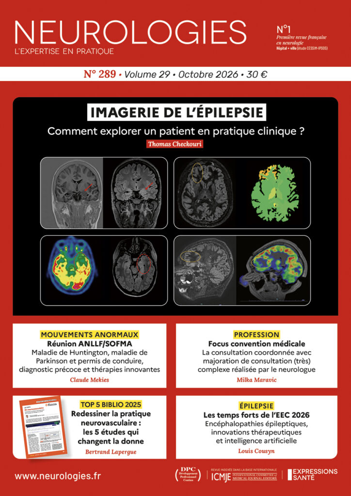 imagerie épilepsie