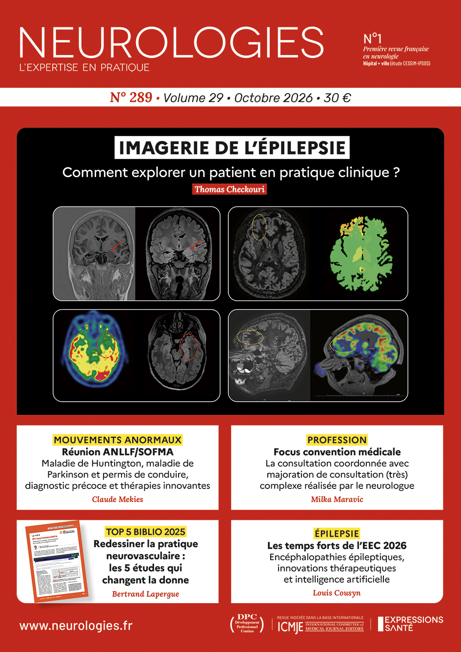 imagerie épilepsie